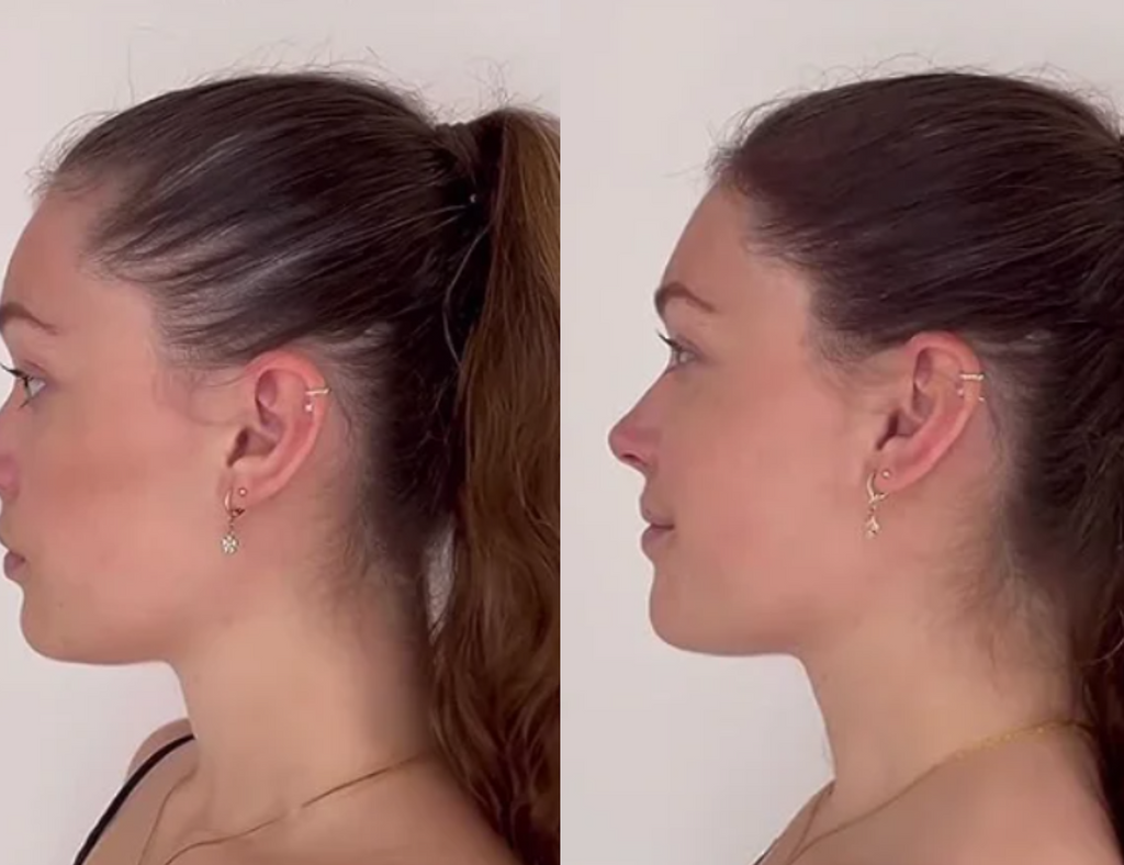 Lustrao Complete Regrowth System-3