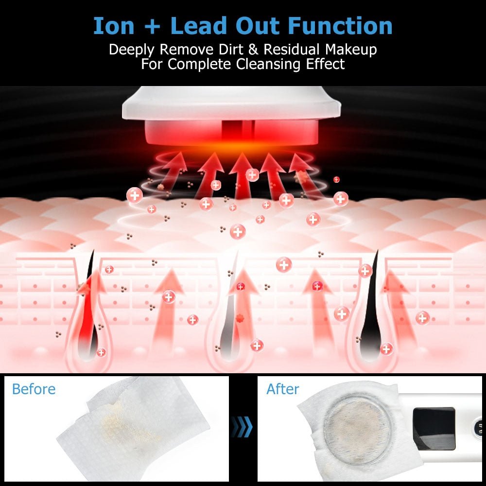 Cleansing Rejuvenation Device LED Photon Therapy Vibration Massager Skin Beauty Instrument Warm Treatment Massage Face Care Tool-4