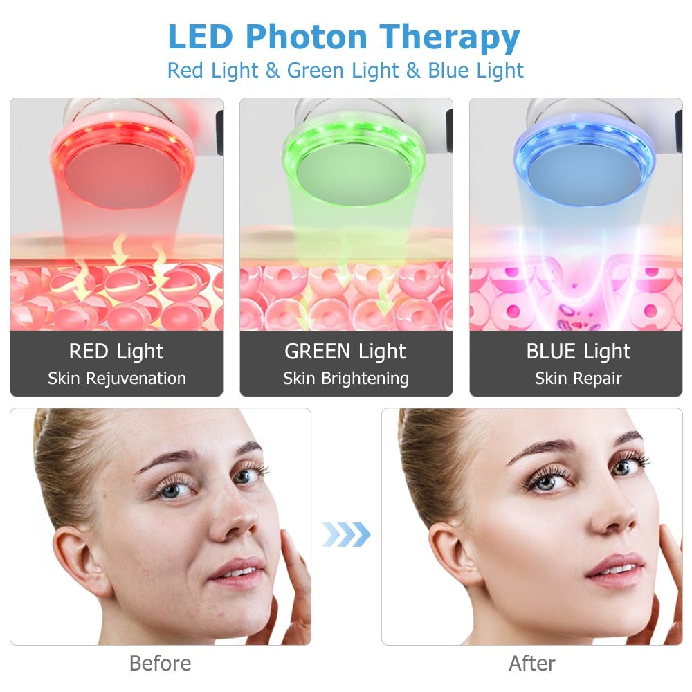 Cleansing Rejuvenation Device LED Photon Therapy Vibration Massager Skin Beauty Instrument Warm Treatment Massage Face Care Tool-3